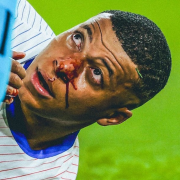 Euro, France, Mbappé, blessure